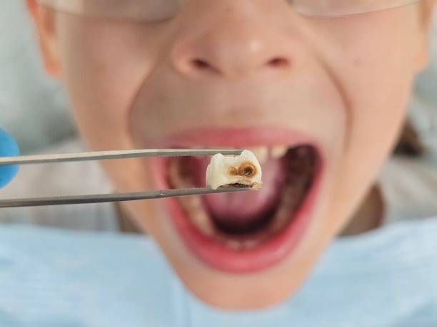 Best Orthodontic Emergency Dentist in Crestwood, IL