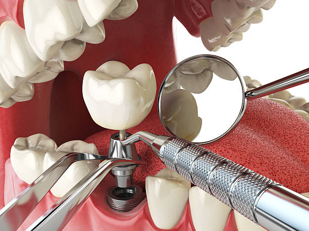Best Orthodontic Emergency Dentist in Crestwood, IL
